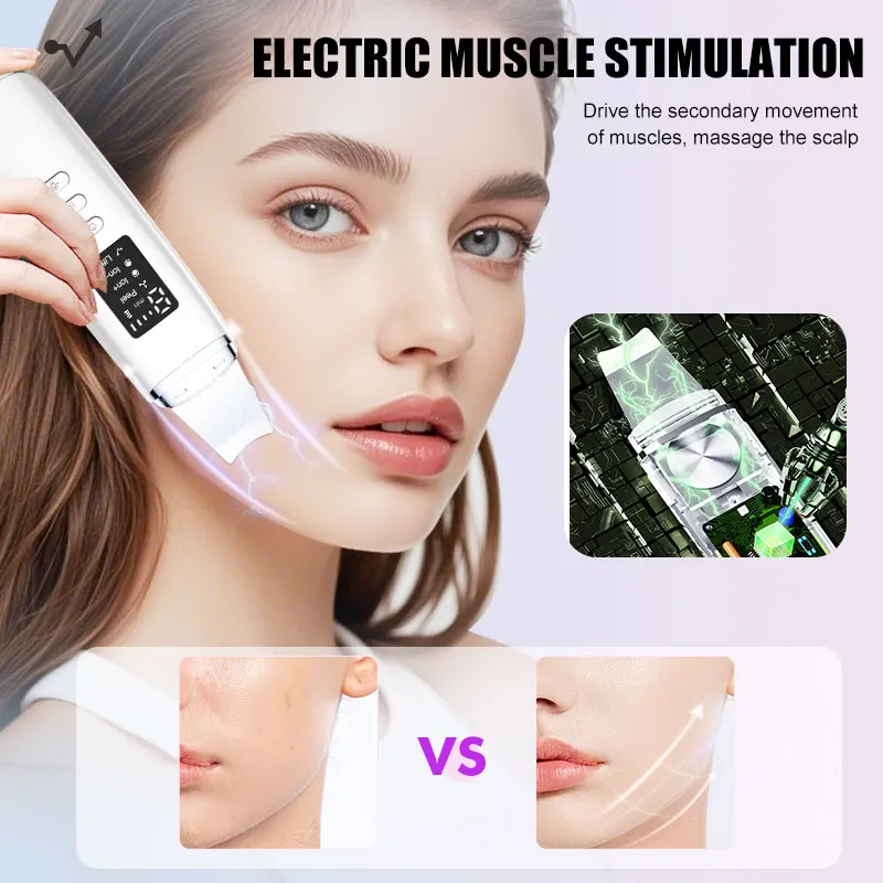 3in1 Ultrasonic Skin Scrubber Facial Lifting Deep Facial Cleaner Acne Blackhead Remover Peeling Shovel Cleaner Facial Massager