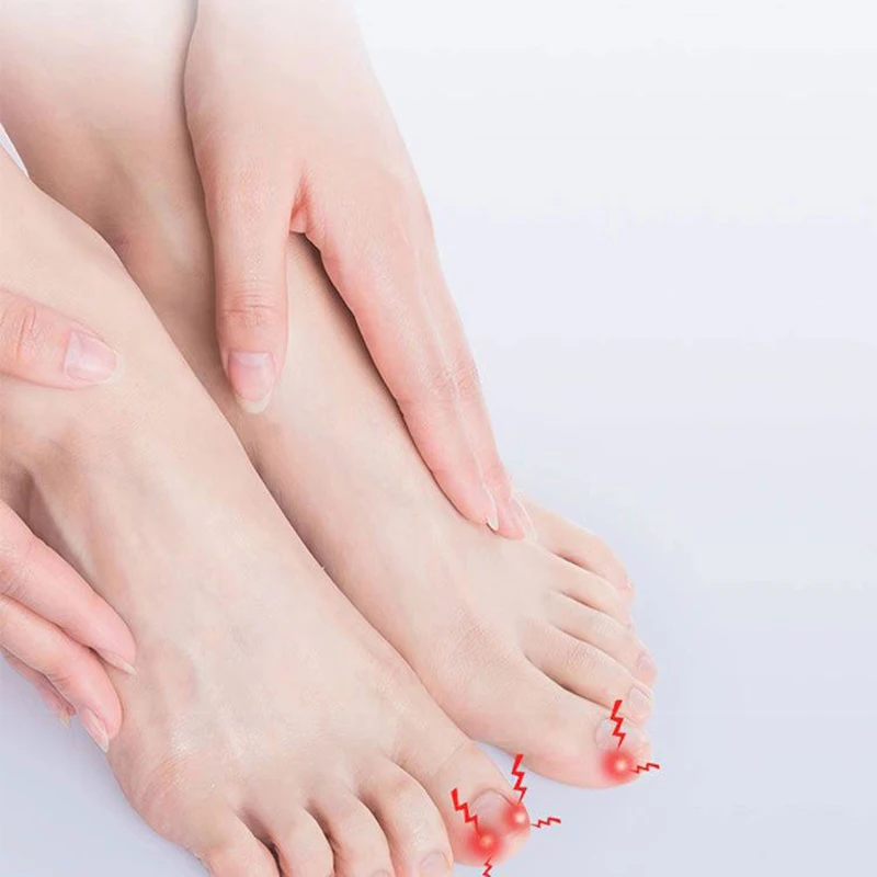 Strumenti per il correttore dell'unghia incarnita Pedicure recupera il trattamento delle unghie dei piedi incorporato strumento professionale per la correzione dell'unghia incarnita del piede