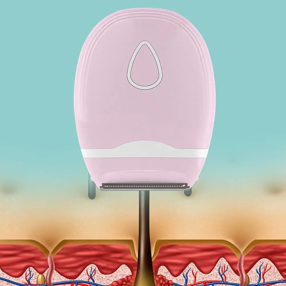 آلة إزالة الشعر غير المؤلمة، آلة إزالة الشعر الآمنة وغير المؤلمة بدون بقع سوداء، ماكينة حلاقة محمولة تحت الإبط للسفر