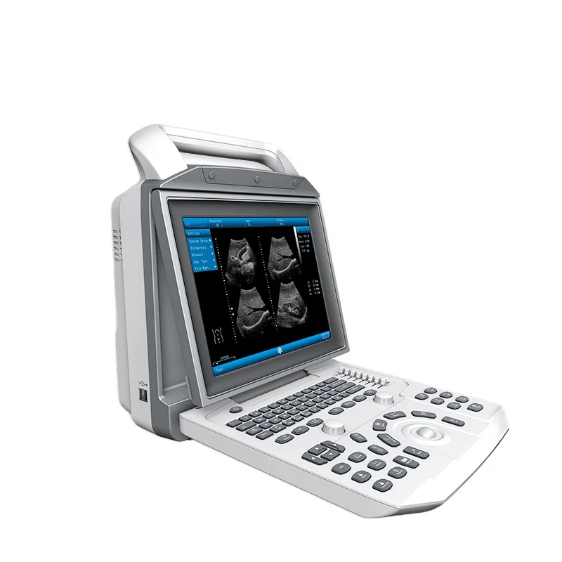 

PBWU50 ultrasound therapy ultrasound scan hand-carried portable Black and White ultrasound machine for hospital