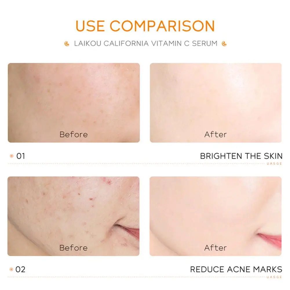 Hidratante vitamina c soro encolher poros clareamento brilho rosto reparação essência feminino rosto cuidados com a pele produto