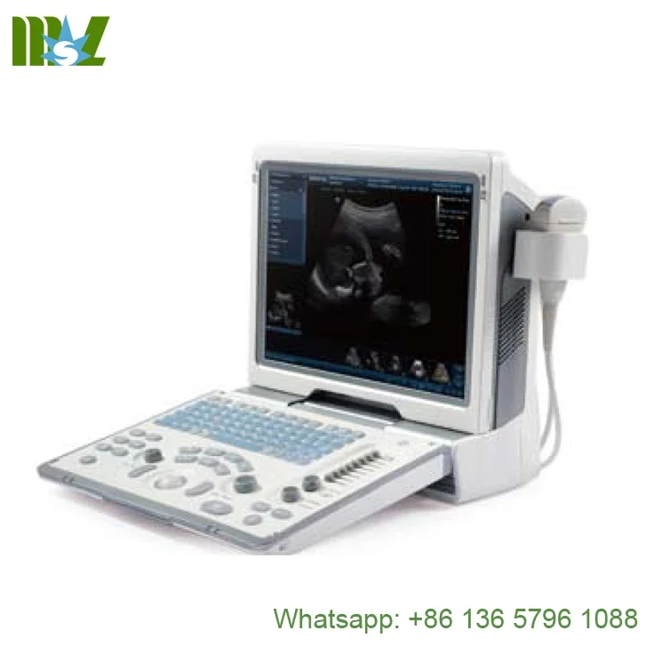 Mindray DP-50 ultrasound machine (with a convex probes)