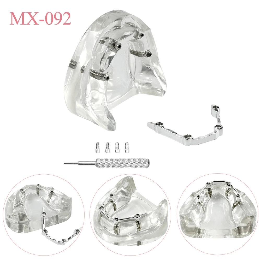 

Модель зубов для имплантации, тренировочная модель нижней челюсти с мягкими деснами, демонстрационная модель для обучения стоматологов, учебные модели для демонстрации полости рта