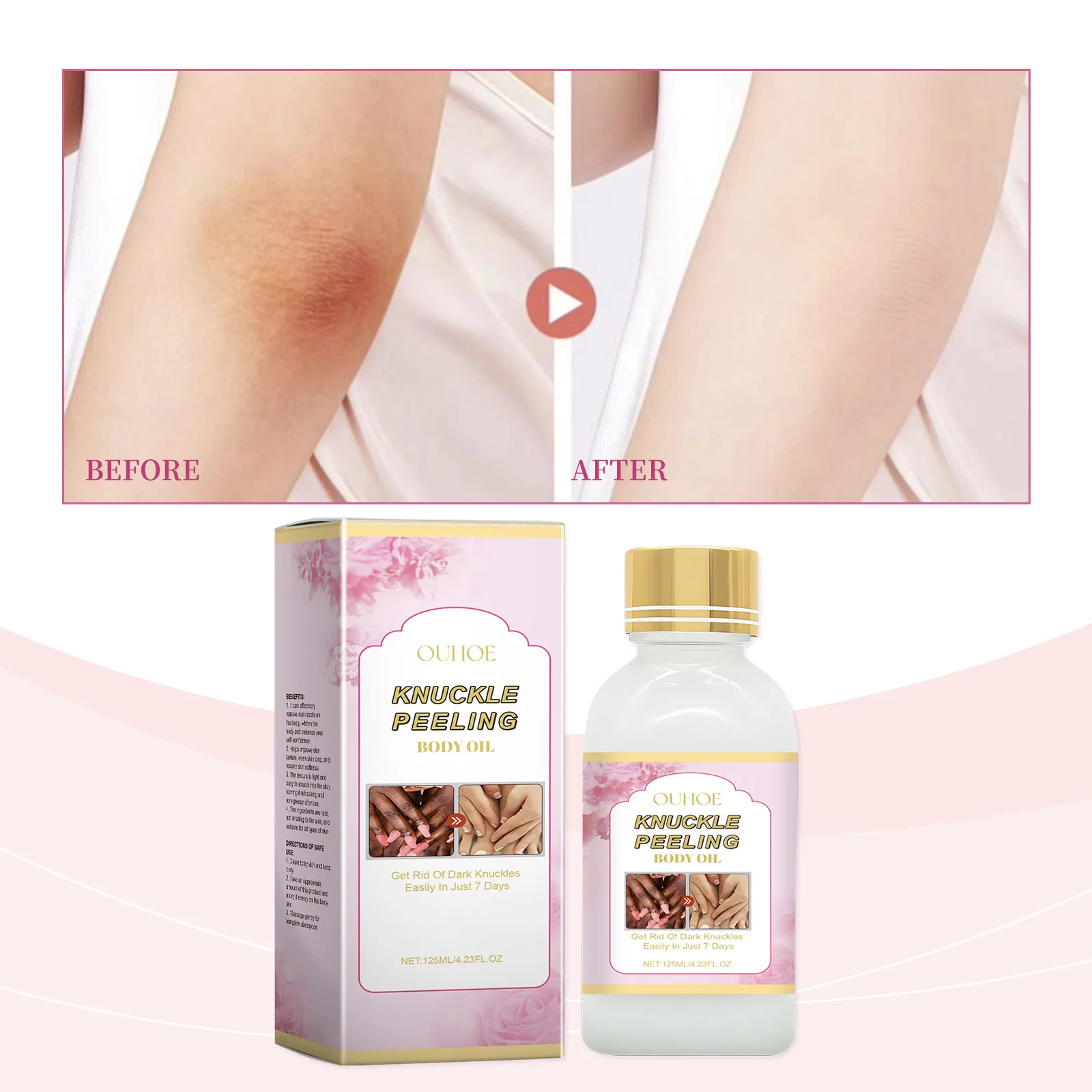 Body Whitening Serum, Moisturizing Vitamin C, Local Joint Care, Lighten Dark Spots, Prevent Aging and Anti-wrinkle Daily Care