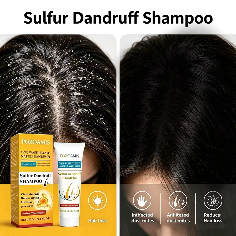Sulfur Dandruff Shampoo, Cleanses Dandruff, Relieves Itching, Reduces Hair Shedding, and Provides Long-Lasting Oil Control.