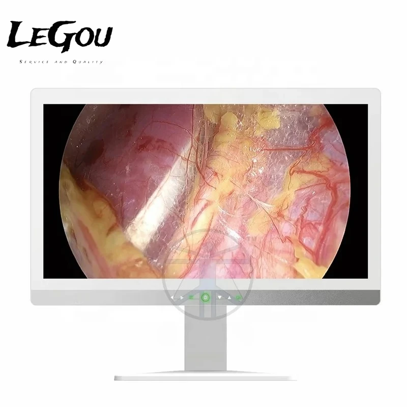 

Монитор LeGou Professional 32 дюйма 4K для медицинского оборудования, используется для эндоскопических камер.
