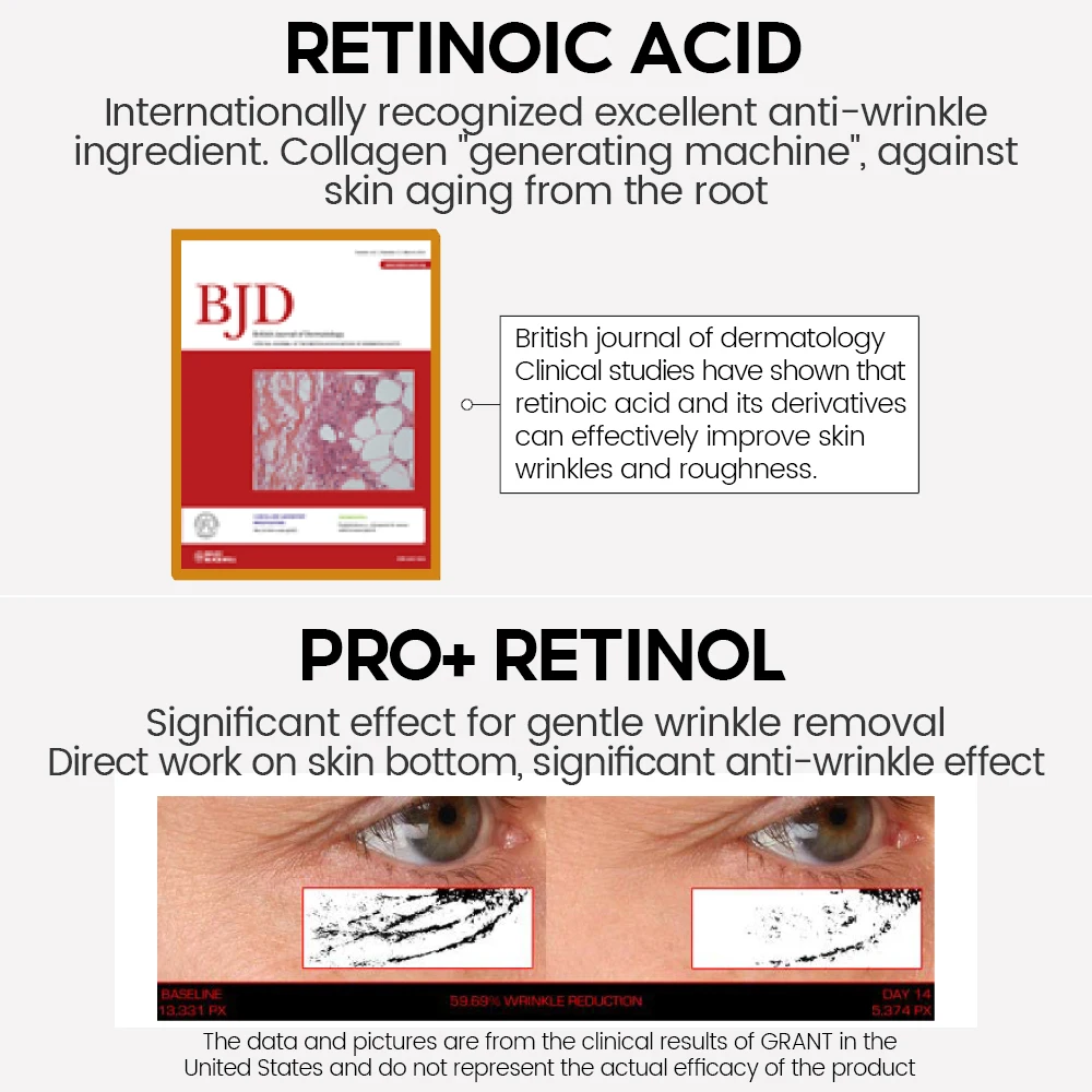 VIBRANT GLAMOUR Retinol Face Serum Pro + 3% Retinol Complex Facial Skin Care 30ML