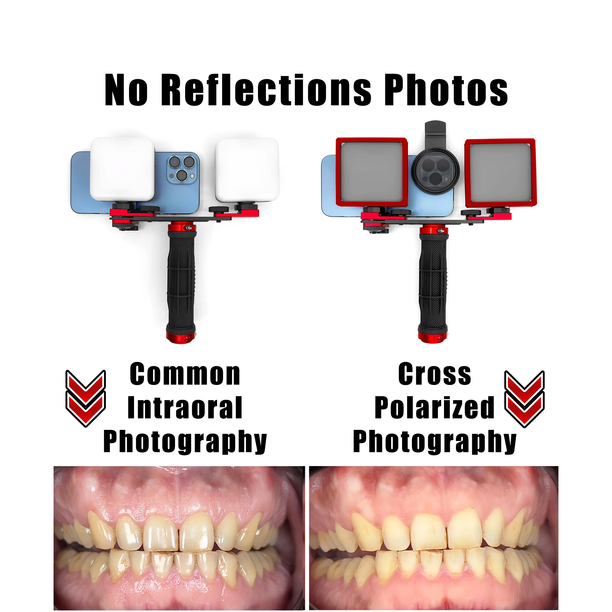 Bluetooth-Set für zahnärztliche Fotografie. Zahnmedizin LED Oral Fülllicht für Foto und Video. Keine Reflexion und Makrozähne Foto