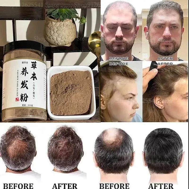 250g Women Men Anti-Hair Loss Hair Growth Hair Thinning Treatment Herbal Hair Care Powder Fast Growing Scalp Treatment Care