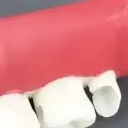 

Инкрустация Модель упражнений Стоматологическая модель Typodont Наполнение Упражнения Смола Блок Красный Белый Стоматологические материалы Инструмент