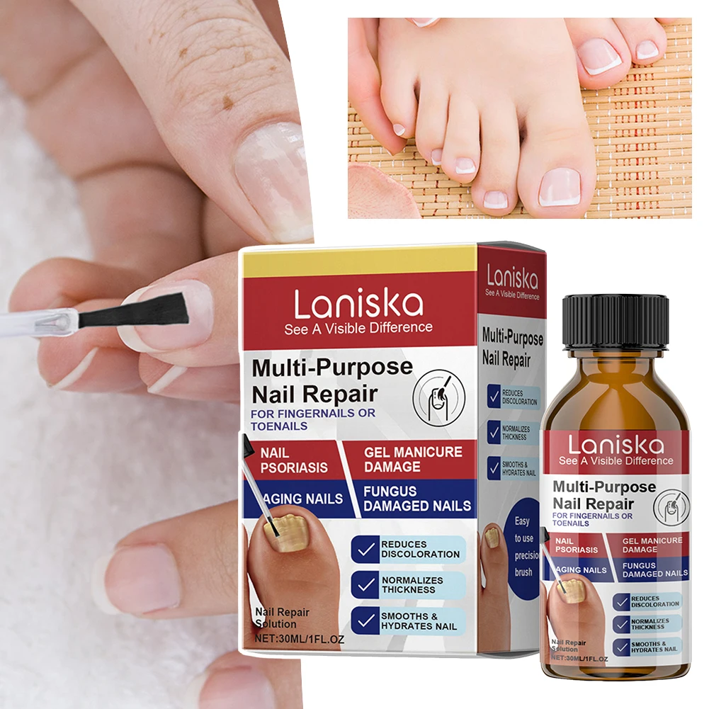 Nagellösung für Nägel mit verfärbten Schäden stellen die Verfärbungsdicke wieder her. Pflege in Salonqualität