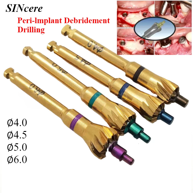 Dental Surgical Grinding Implanted Bone Profiler Grinding Bur with Pilot Drill Peri-Implant Debridement Drill for OSSTEM Dentium