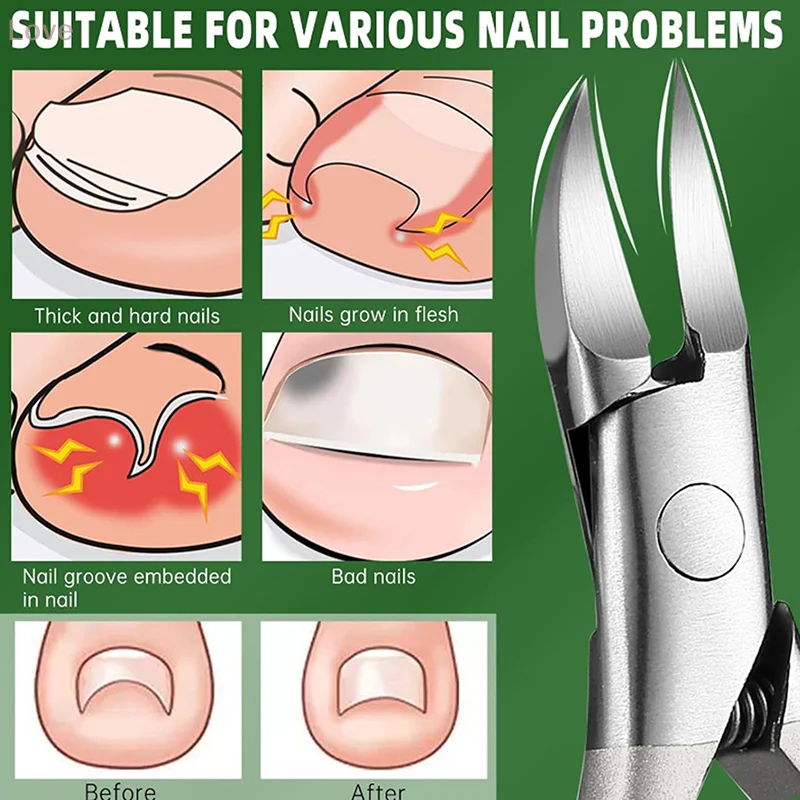 Professional Sharp Oblique Mouth Nail Clippers Trimmer Cutters Anti Sling Care Tools Chiropody Podiatry Stainless Foot Care Tool