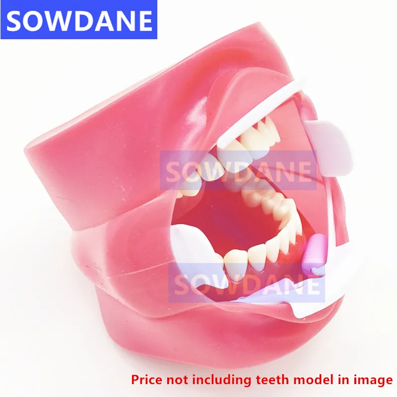 Dentes reutilizáveis branqueamento suporte para adultos, ferramenta ortodôntica dental, oral e intraoral, bochecha lábio retrator, abridor de boca, 3D