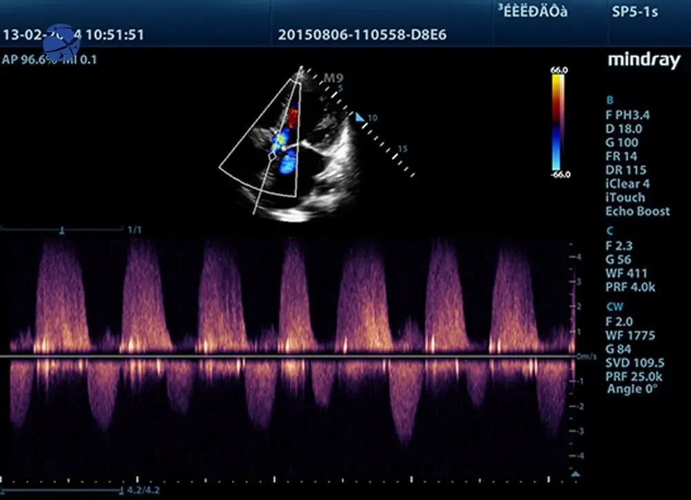 Mindray M9 Portable 3D/4D Color Doppler Ultrasound Machine Ultrasound Scanner Machine Price