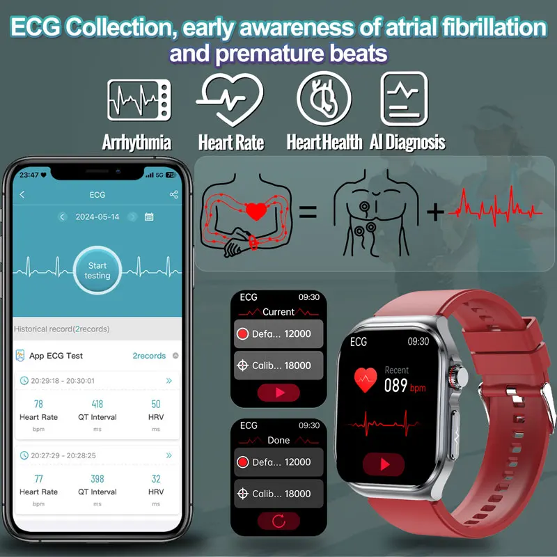 2024 neue medizinische Qualität Smartwatch Männer Blutzucker Lipid Harnsäure Uhren NFC 530mah Health Tracker Anruf Smartwatch für Frauen