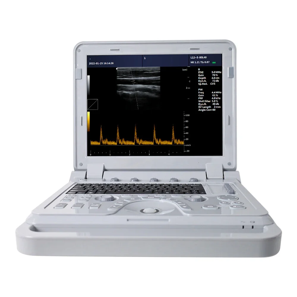 CONTEC CMS600P2 PLUS  portable ultrasound machine pseudo color doppler medical ultrasound Pulse Spectral Doppler instruments