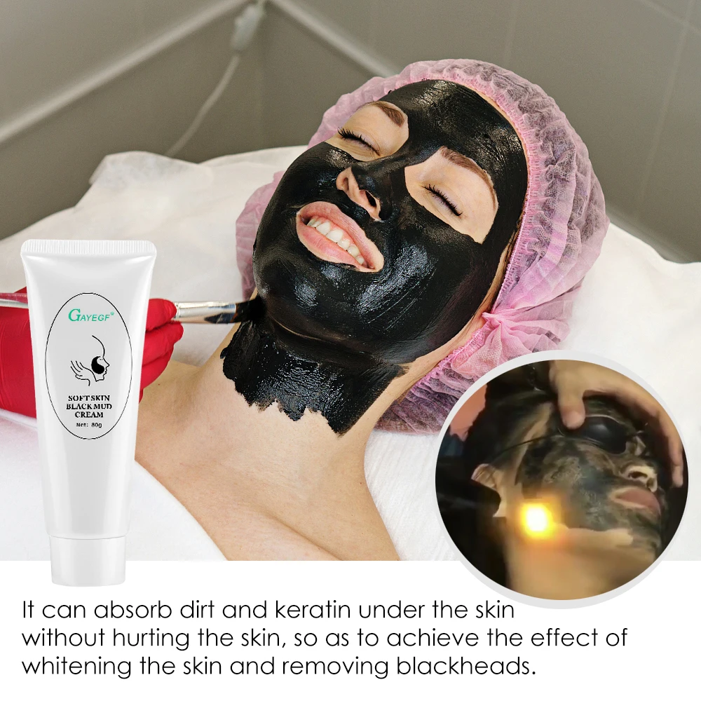 Neue Carbon Gel Tiefen Reinigung Feuchtigkeitsspendende Schwarze Gesichtscreme Für Laser Haut Verjüngung Entfernung Mitesser Bleaching Hautpflege