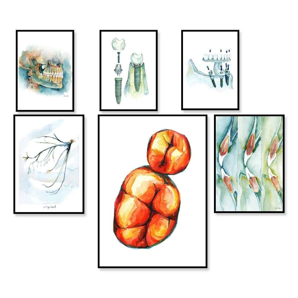 Dental Implant Wate… - image