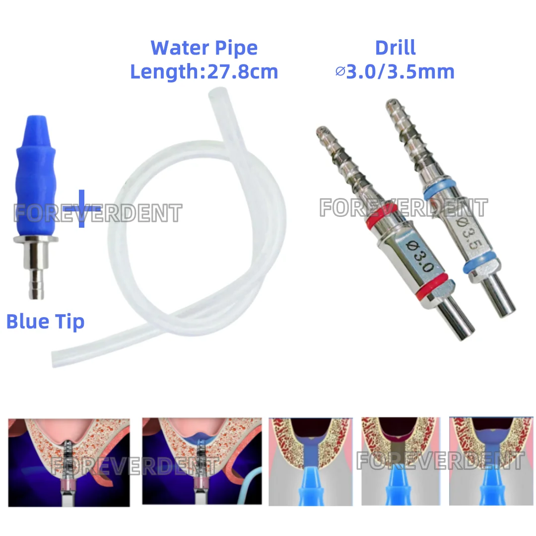 Dental Water Lifter Rising Pipe Hydraulic Membrane Lifter Drill Hiossen Sinus Lift Drills 3.0mm/3.5mm