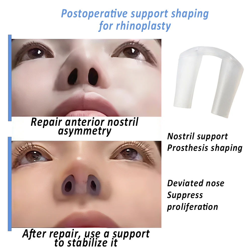 Nose Retainer Surgery Silica Gel Nose Clip Nostril Retainer for Rhinoplasty Shaping Recovery Nose Shaper Support Fixator Device