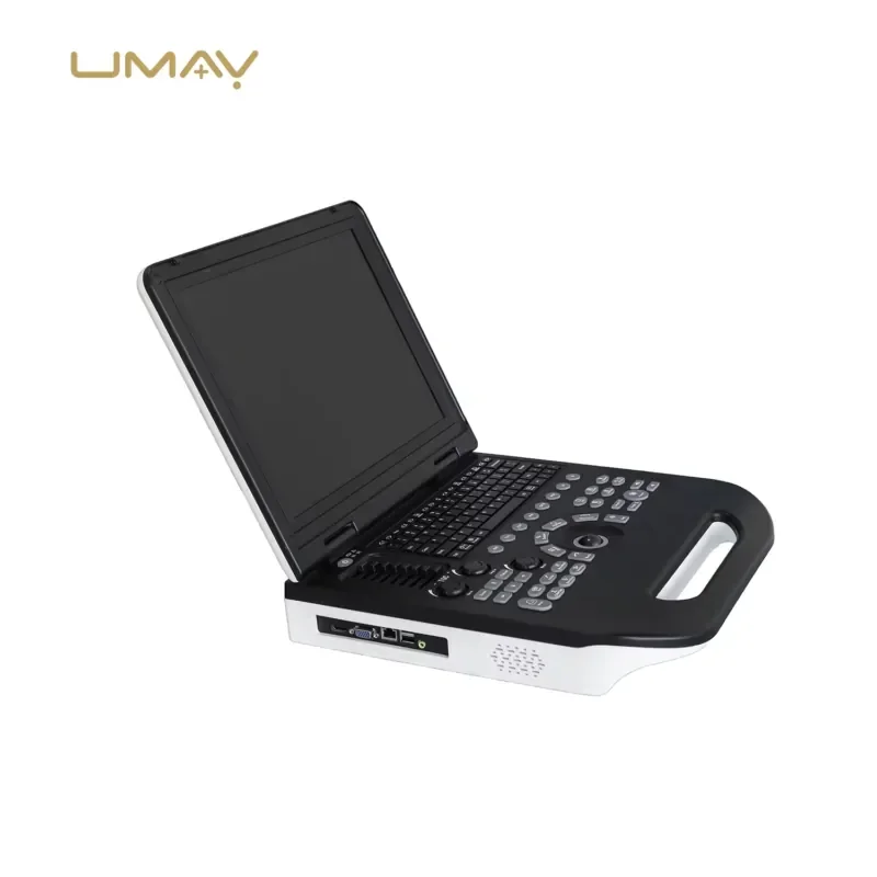 UMUS031 High Quality Medical Diagnostic Portable Machine with Convex Probe 15