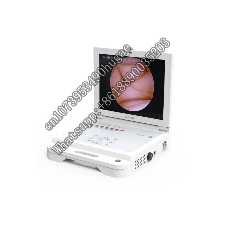 

SY-PS045N all in one 17 inch CCD system for gynecology/Urology/ENT