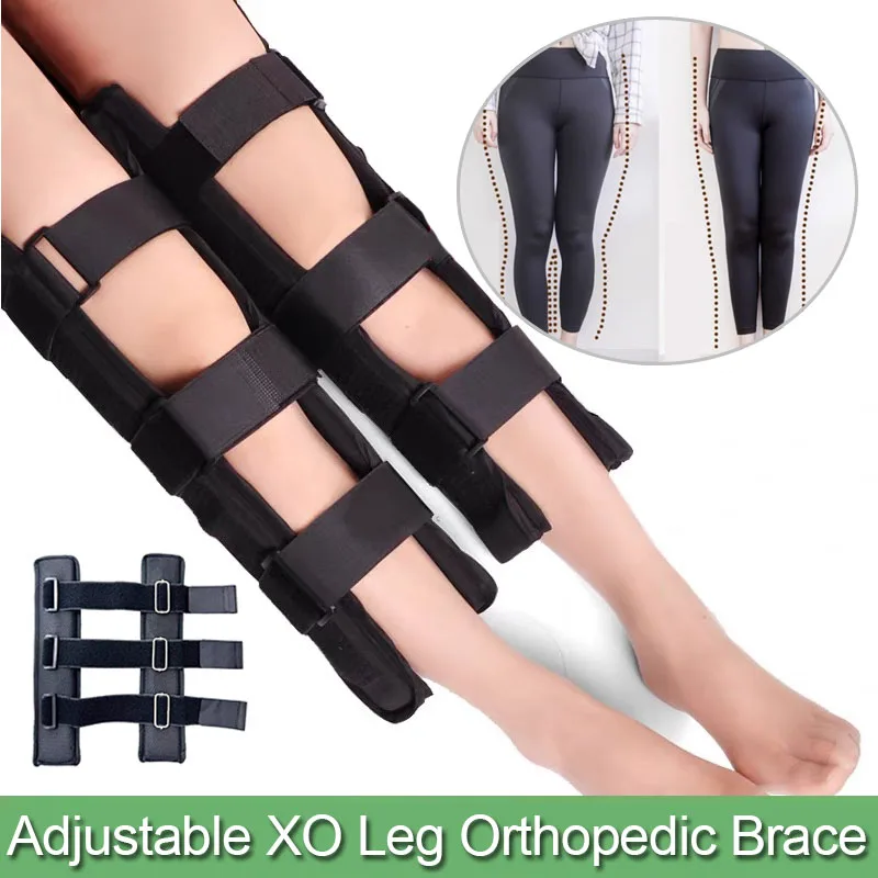 Adjustable Effective Bow Type O Leg Correction Belt-Knee Valgum Straightening Corrector-Legs Posture Corrector Brace