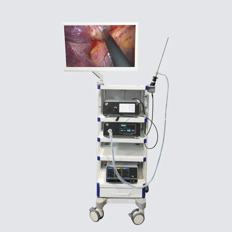 4K Medical Endoscopy Camera System 3840 * 2160P Utero-abdominal/Urinary/ENT Endoscopy System
