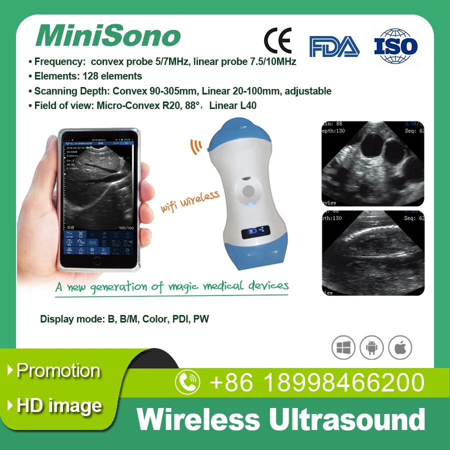 

Wireless ultrasound probe Linear and micro-convex color doppler version wifi connect support IOS, Android,Windows, Free App