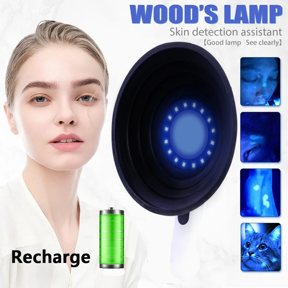 UV Woods Light Vitiligo Detection Woods Lamp Skin Examination Skin Detector Analyzer For facial Skin Magnifying Analyzing