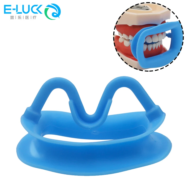 1szt Dental Mouth Open Soft Silicone Orthodontic Cheek Retractor 3D Lip Expand Mouth Opener Dentist Oral Care Tool