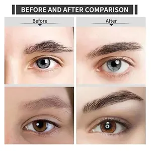 ماكينة حلاقة الحواجب الكهربائية الذكية ، أداة القلم ، الرجال والنساء ، ماكينة حلاقة نظيفة للسيدات ، ماكينة حلاقة أوتوماتيكية ، آلة إزالة الشعر ، الجمال ، إزالة الشعر أعلى 12 مبيعات لإزالة الشعر للقضيب - رقم 1