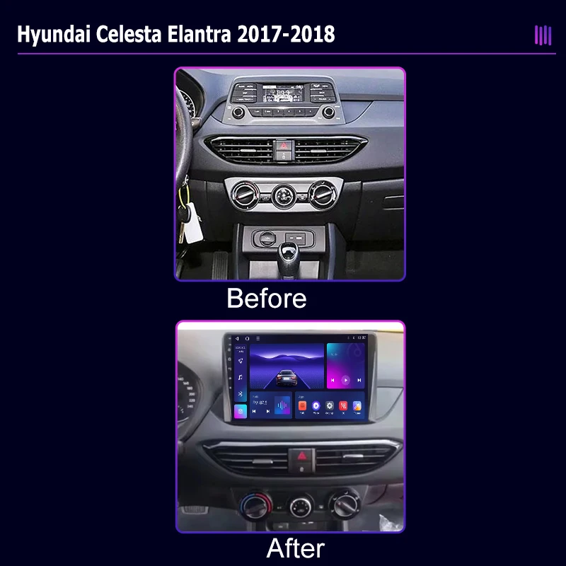 roadivox Android car radio for Hyundai Celesta Elantra 2017 2018 stereo GPS Navigation video Multimedia Player tape recorder