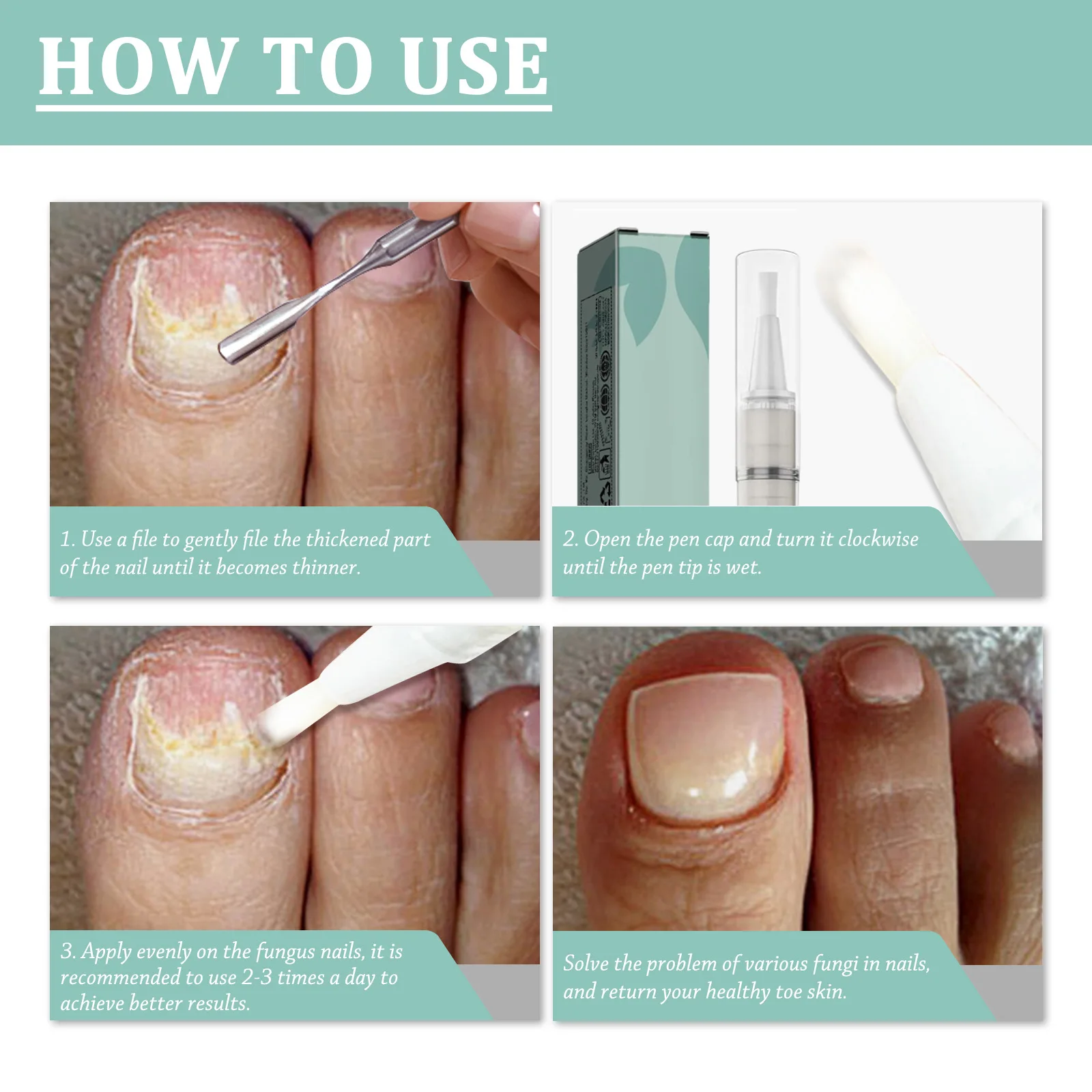 Caneta de reparação de unhas anti unhas tratamento de infecção fúngica seco hangnails fortalecedor pés paroníquia remoção dedo do pé onicomicose cuidados