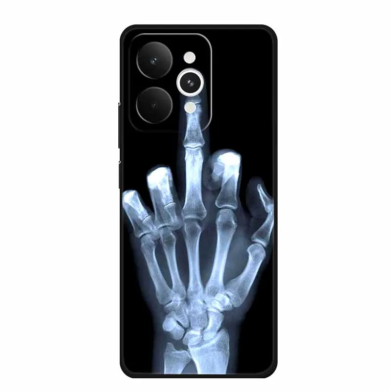 حافظة لهاتف Realme 15 5G حافظة هاتف عصرية غطاء خلفي ناعم من البولي يوريثان الحراري لهاتف Realme 15 Pro 5G Funda مقاوم للصدمات حقائب سيليكون فاخرة