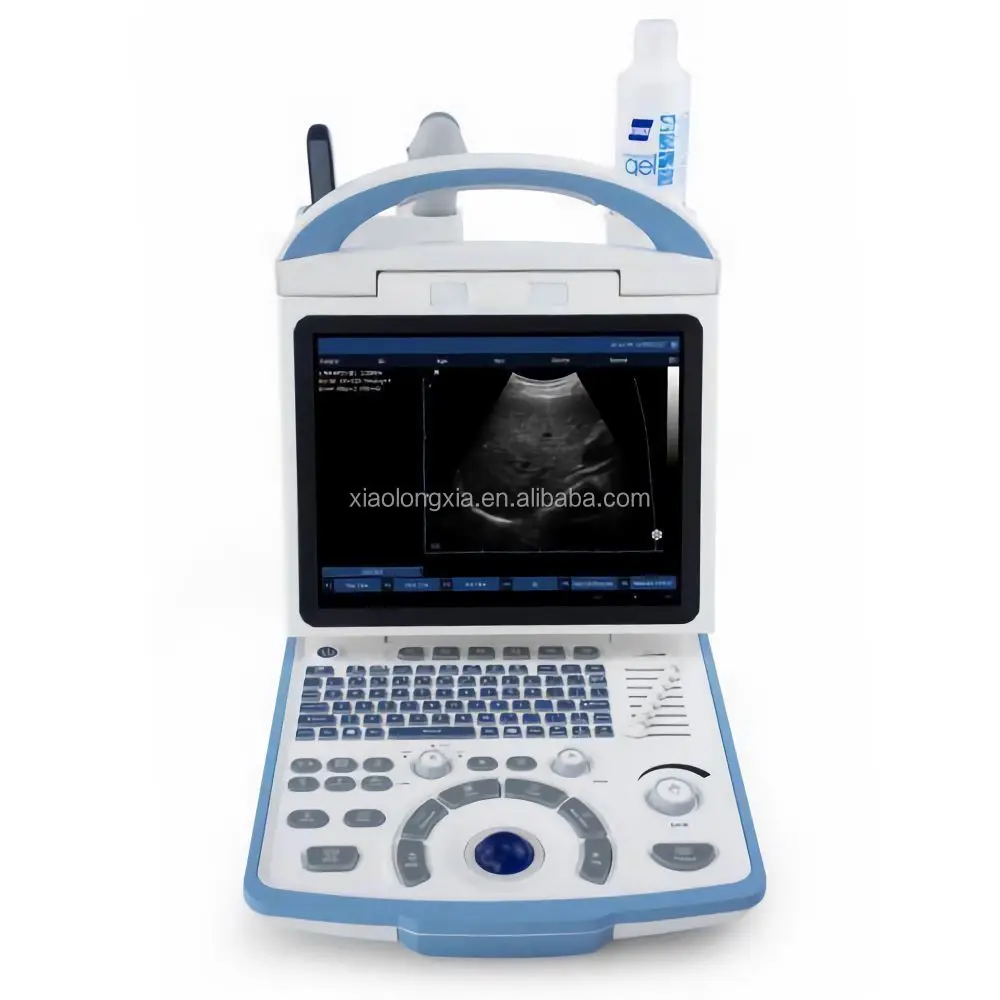 High Quality Ultrasound Full Digital Ultrasonic Diagnostic Imaging System Portable Color B Ultrasound Machine