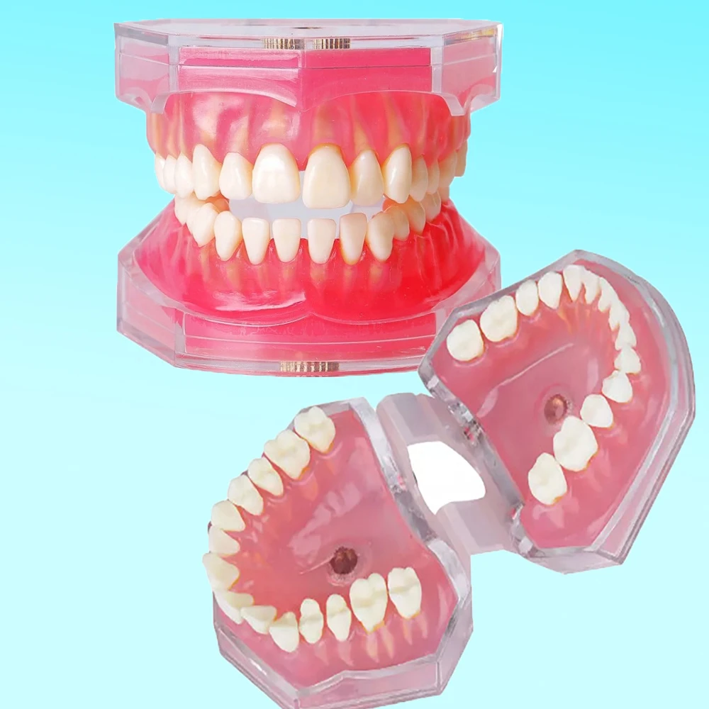 

Dental Soft Gum Standard Tooth Model Dental Study Teaching Jaw Model Extraction Pratice Removable Teeth Dentistry Study Products