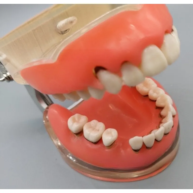Dental Periodontal Pathology Model Soft Gingiva For Calculus Gingival Recession Scaling Curettage Training Demonstration Model