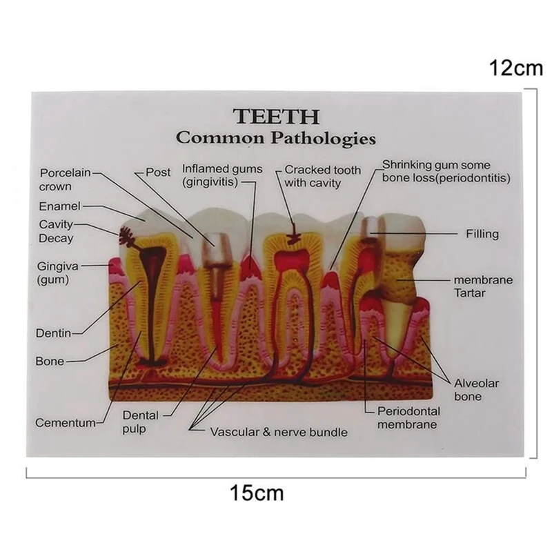 ABNO-Standard  Oral Teeth Anatomical Teaching Model Comprehensive Tooth Structure Model Dentist  Demonstration