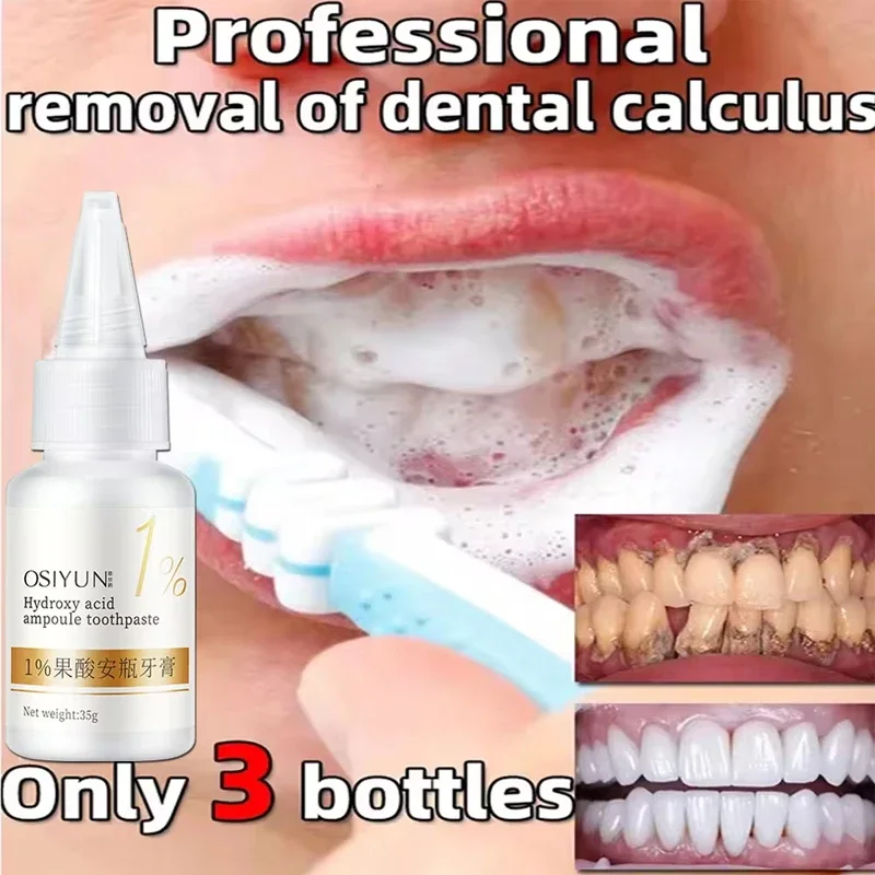 Teeth Whitening Toothpaste Fruit Acid Remove Plaque Stains Calculus Fresh Breath Cleaning Oral Hygiene Dental Bleach Care Tools