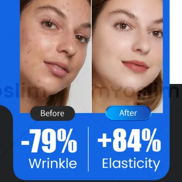 4 in 1 Morpheus8 Microneedling Facial Treatment Device Fractional RF Skin Tightening Anti-Aging Wrinkle Reduction Beauty Tool