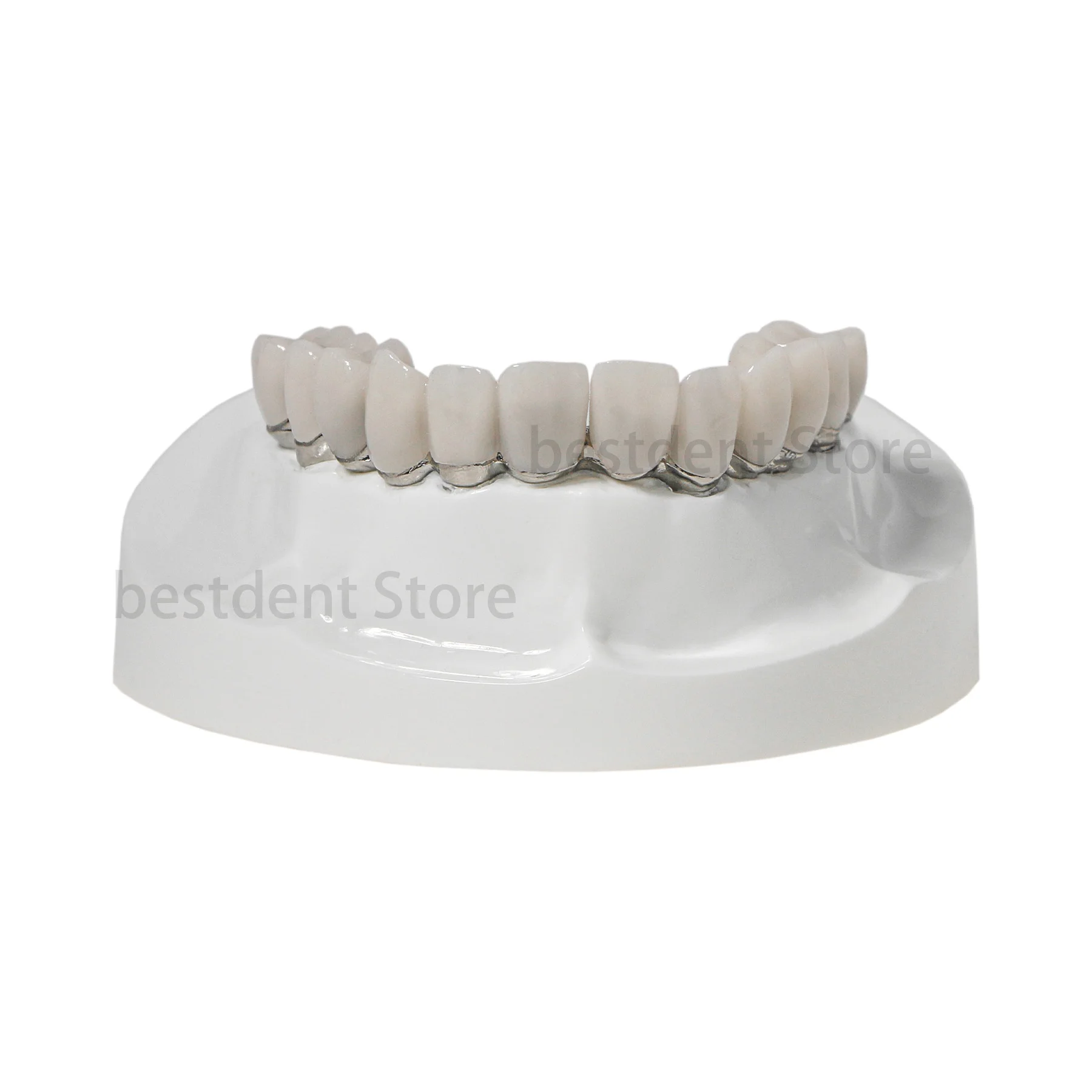 Dental Implant Teeth Model Overdenture Upper Jaw Restoration Screwdrivers Model 4 Screws M6023