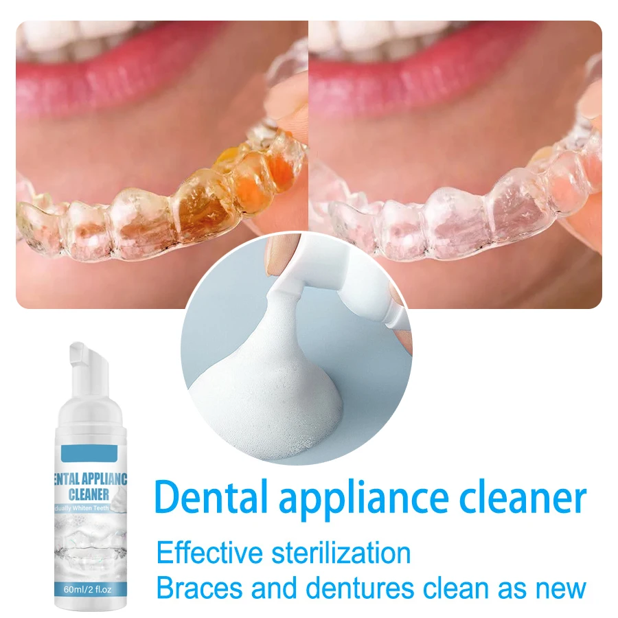 Retainer & Mondbeschermer Schoner Schuim-60Ml: Diep Schoon, Witter, Elimineer Geur & Vergeling Voor Beugels En Aligners