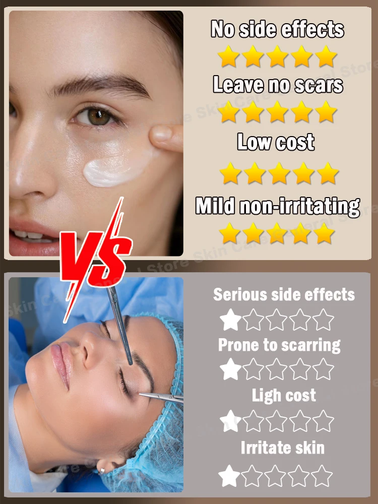 Eye Bags Cream Remove Eyes Wrinkle