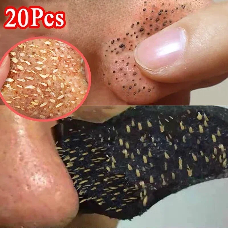 20pc Bamboo Charcoal Blackhead Mask Blackhead Spots Acne Treatment Mask Nose Sticker Cleaner Nose Pore Deep Clean Strip