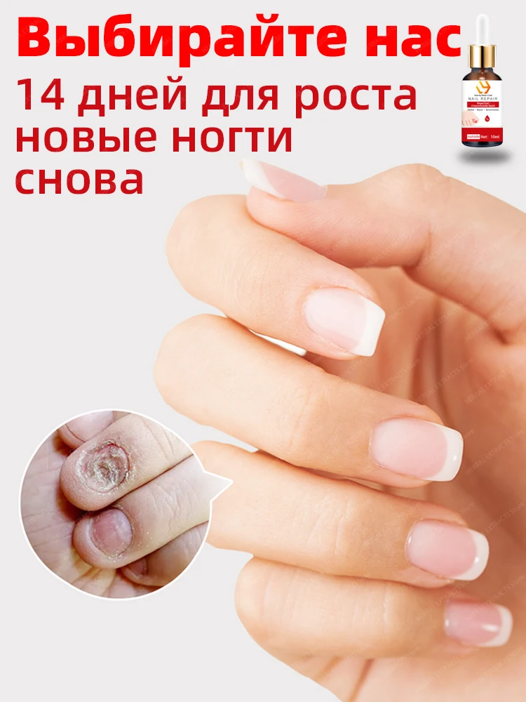 Nail Fungus Repair Toenails Nail Polish Fungus Effective R-emoval