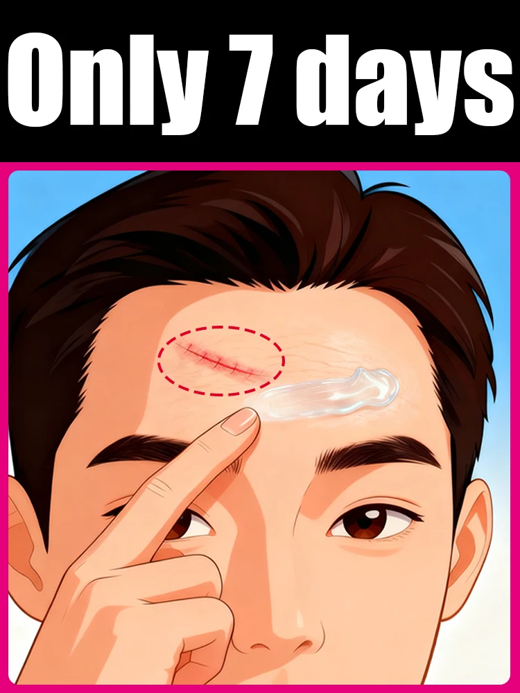 2025 venda quente limpeza cicatriz stickh ferramentas de limpeza de poeira de plástico escovas cicatriz arte ferramenta