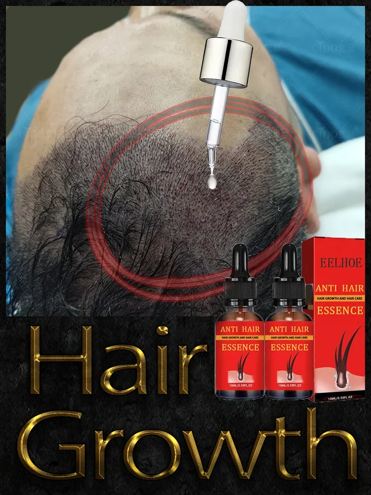 Prevent shedding, Grow hair, reduce hair loss,