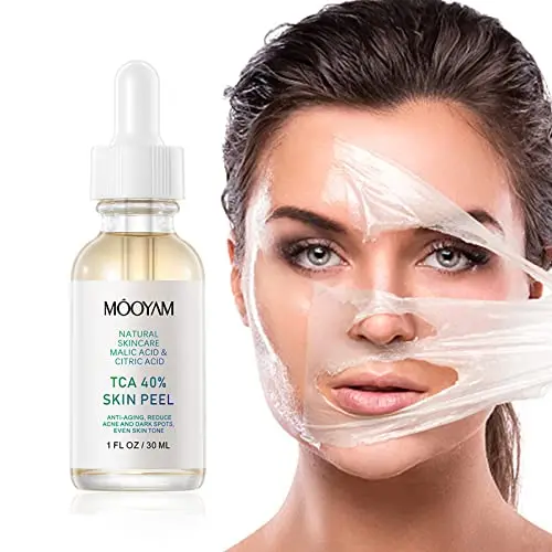 

Facial Peel Chemical Peel 40% Peeling Serum with Malic Acid and Citric Acid Peeling Solution Face Exfoliator for Face